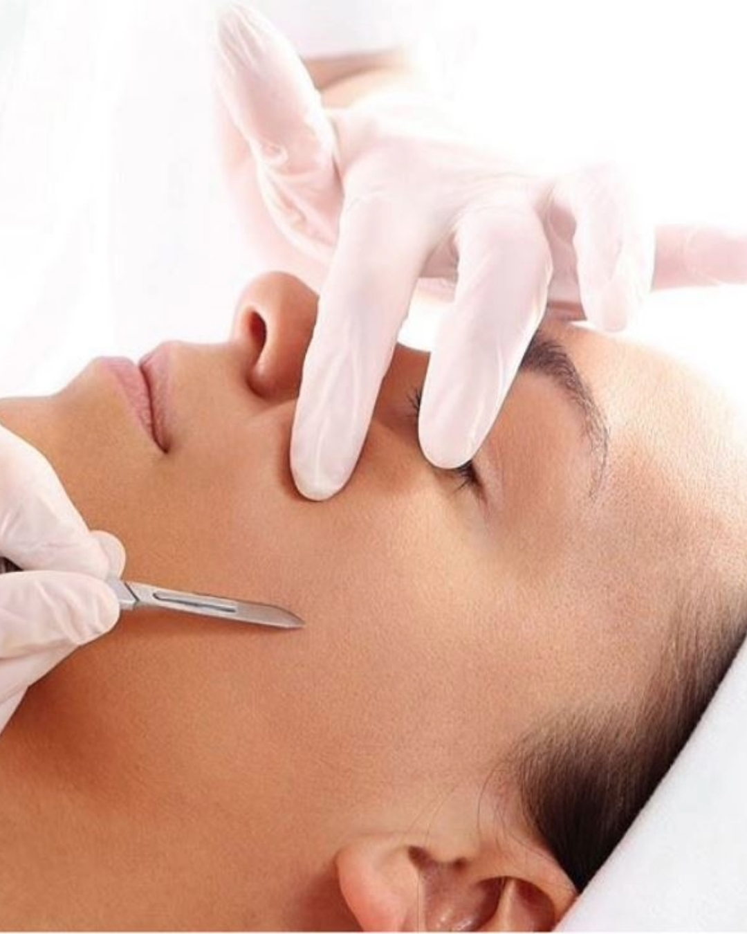 Dermaplaning at Muse Hair & Beauty in Broadway Dermaplaning at Muse Hair & Beauty in Broadway